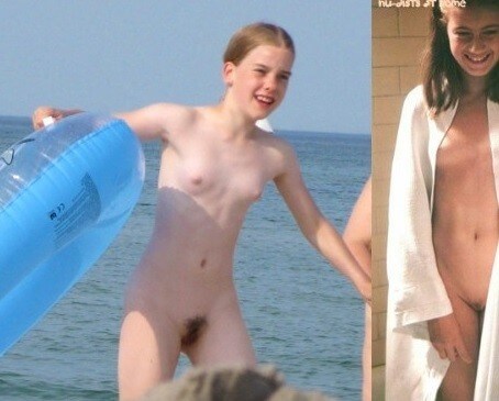 Bare Lake Days photos - Nudism as a way to overcome body image issues and stereotypes